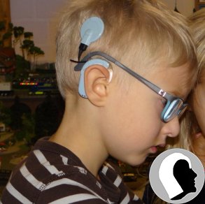 CI Kopf 2018 männlich Kind